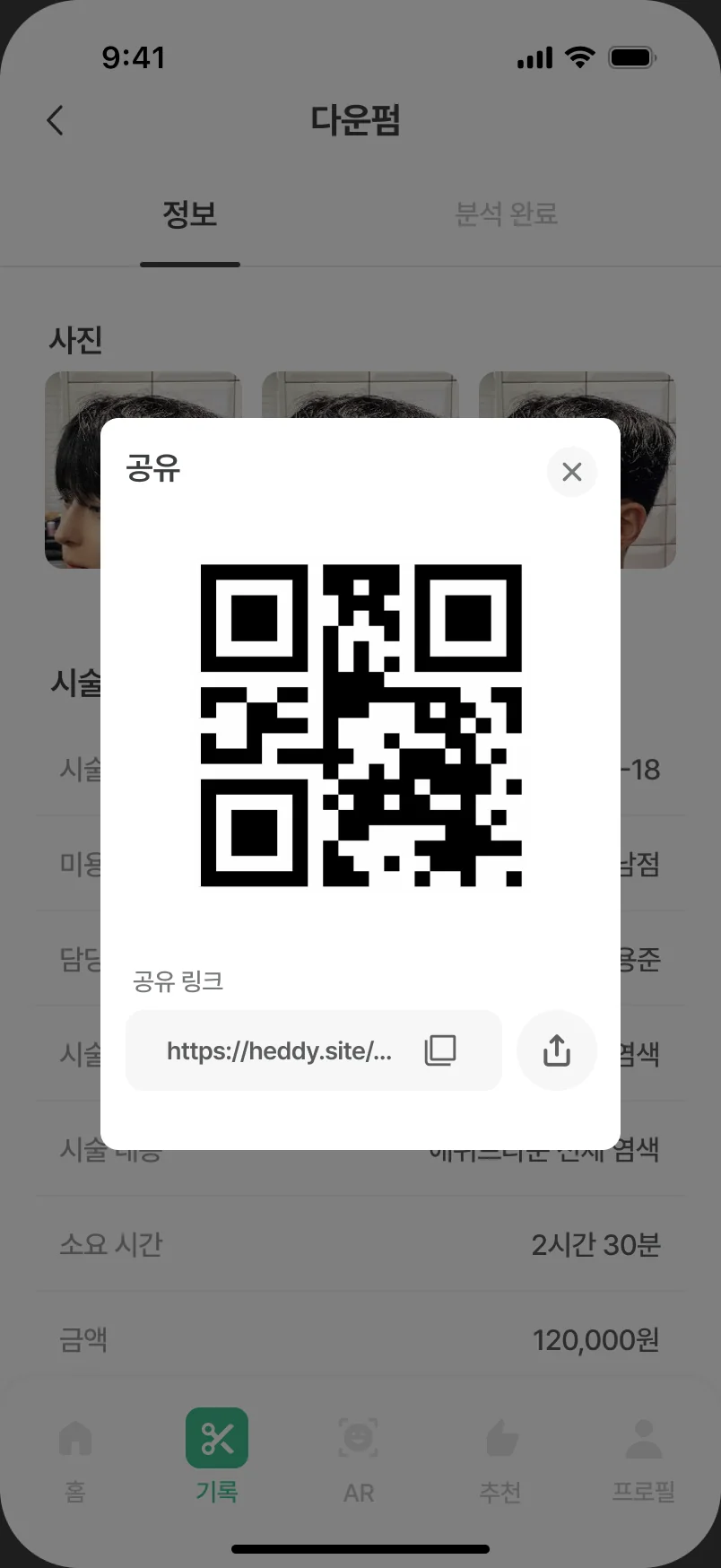 시술 기록 공유 QR 화면